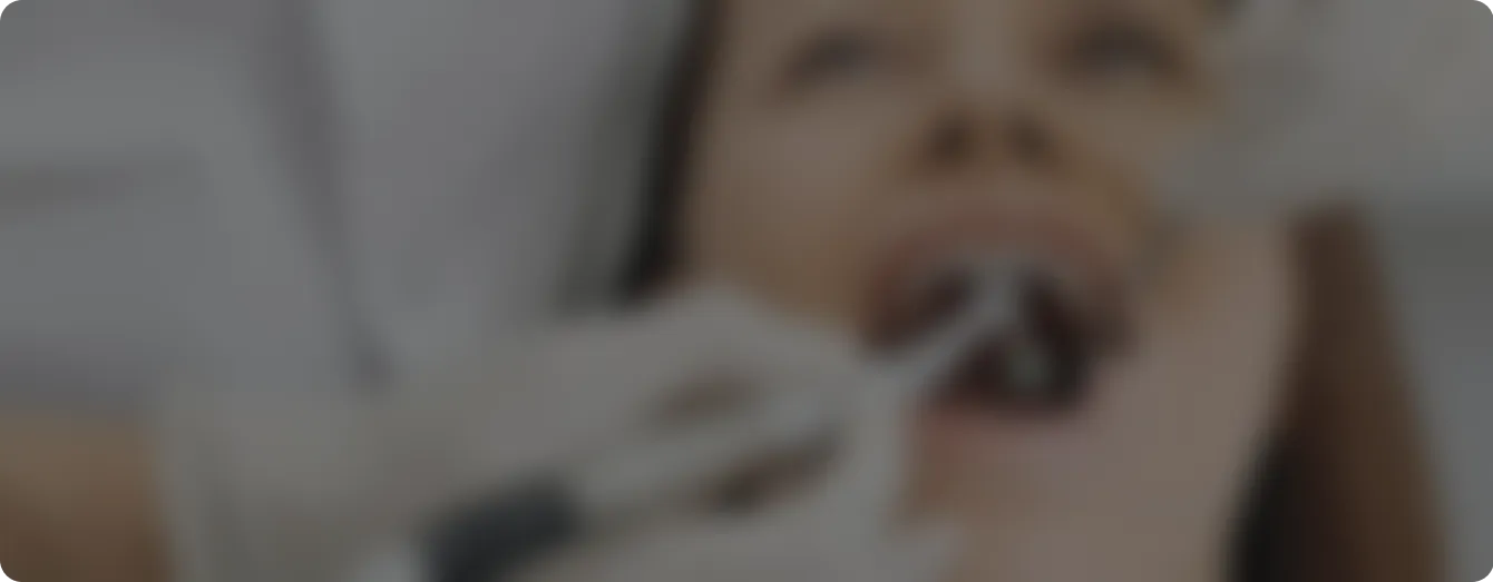 4 steps of our process